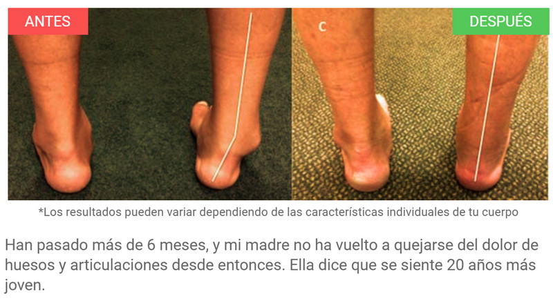 Bioforce contraindicaciones